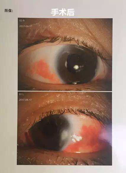 成都新利体育白内障.jpg 成都新利体育白内障.jpg