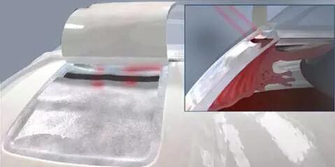 10月24日,成都新利体育CO2激光辅助深层巩膜切除术培训会圆满落幕。本次培训会由成都新利体育青光眼科主任、副主任医师胡建旗医生用猪眼为参会人员演示了CLASS手术全过程并指导学员进行了实际操作,学员们纷纷表示手术操作简单易懂易学,培训活动取得圆满 。.jpg 10月24日,成都新利体育CO2激光辅助深层巩膜切除术培训会圆满落幕。本次培训会由成都新利体育青光眼科主任、副主任医师胡建旗医生用猪眼为参会人员演示了CLASS手术全过程并指导学员进行了实际操作,学员们纷纷表示手术操作简单易懂易学,培训活动取得圆满 。.jpg