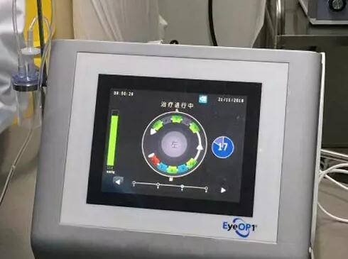 成都新利体育医院院长陈晓明教授为资阳市安岳县青光眼患者进行青光眼超声睫状体成形术3.jpg 成都新利体育医院院长陈晓明教授为资阳市安岳县青光眼患者进行青光眼超声睫状体成形术3.jpg