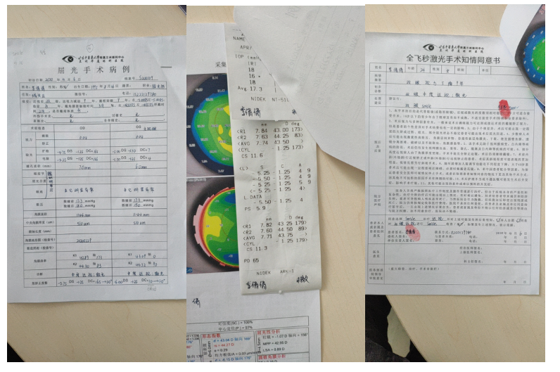 兰州全飞秒近视手术术前检查单 兰州全飞秒近视手术术前检查单