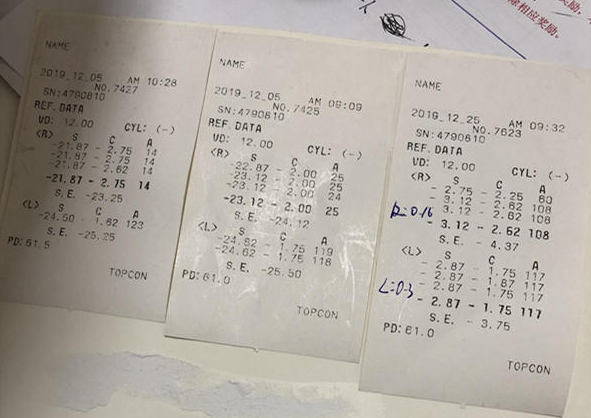 在杭州新利体育高度近视手术后,近视2550度配不到眼镜的四川大哥,看清了!2.png 在杭州新利体育高度近视手术后,近视2550度配不到眼镜的四川大哥,看清了!2.png