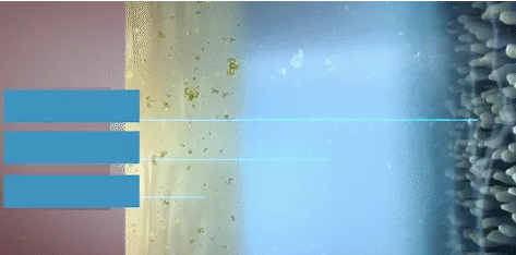 睑板腺功能障碍性干眼该怎么医治?厦门 眼科中心医生这样说2.png 睑板腺功能障碍性干眼该怎么医治?厦门 眼科中心医生这样说2.png