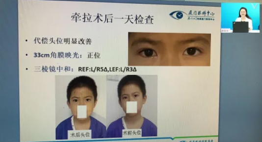 高峰论道·云端荟萃 ▏万人同步在线,30余名大咖云集“第六届新利体育论坛斜视与小儿眼科新技术学习班暨小儿、眼视光分论坛”7.png 高峰论道·云端荟萃 ▏万人同步在线,30余名大咖云集“第六届新利体育论坛斜视与小儿眼科新技术学习班暨小儿、眼视光分论坛”7.png