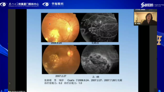 高峰论道·云端荟萃 ▏万人同步在线,30余名大咖云集“第六届新利体育论坛斜视与小儿眼科新技术学习班暨小儿、眼视光分论坛”6.png 高峰论道·云端荟萃 ▏万人同步在线,30余名大咖云集“第六届新利体育论坛斜视与小儿眼科新技术学习班暨小儿、眼视光分论坛”6.png