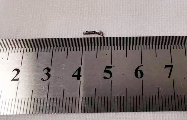 新利体育徐州复兴眼科王海菊:妙手拨迷障,匠心护光明3.png 新利体育徐州复兴眼科王海菊:妙手拨迷障,匠心护光明3.png