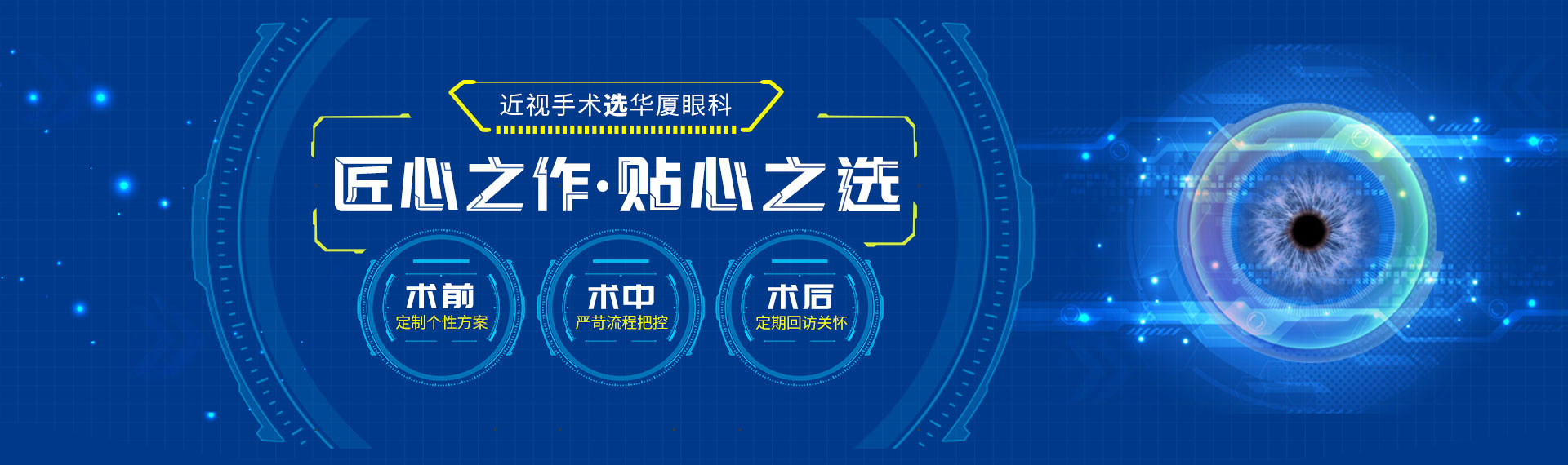 近视手术选新利体育